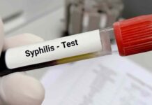 Casos de sífilis en adultos aumentaron en las Américas
